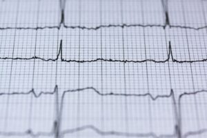 Image of an EKG.